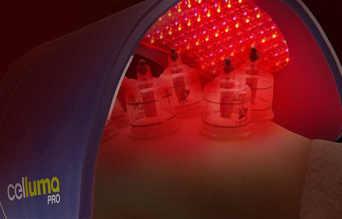 LEDライトセラピー 筋肉痛を和らげ炎症にアプローチ